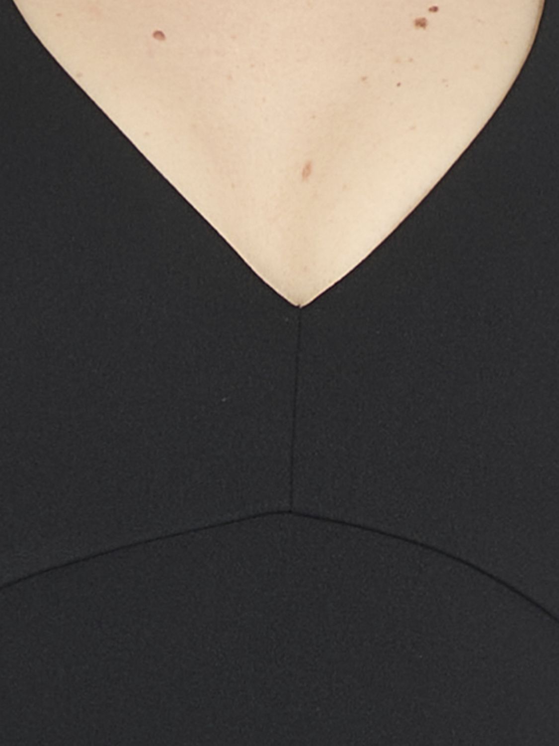 Solace London Dress Woman Black SOLACE LONDON